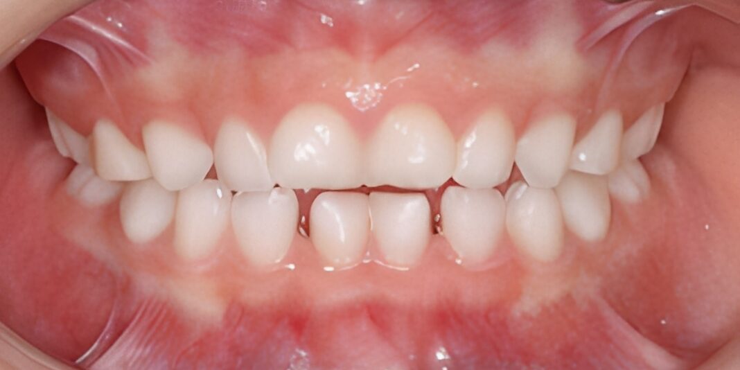 ※画像の鮮明化にのみAIを使用しています。
