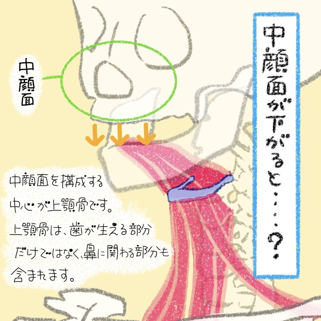 中顔面を構成する上顎骨は歯と鼻に関わる骨