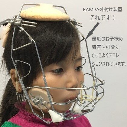 こどもの矯正とランパセラピー