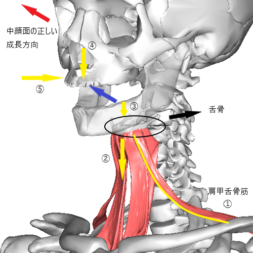 こどもの矯正とランパセラピー