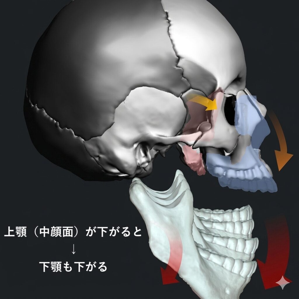 口呼吸（舌が上顎につかない）状況下での上下顎の骨格変化のイメージ